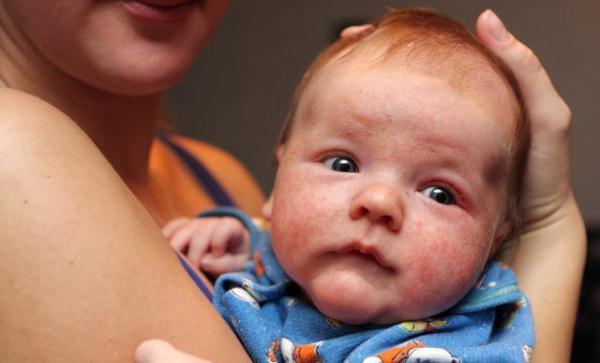 如何给婴幼儿做面部日常护理（宝宝日常护理的6步细节）